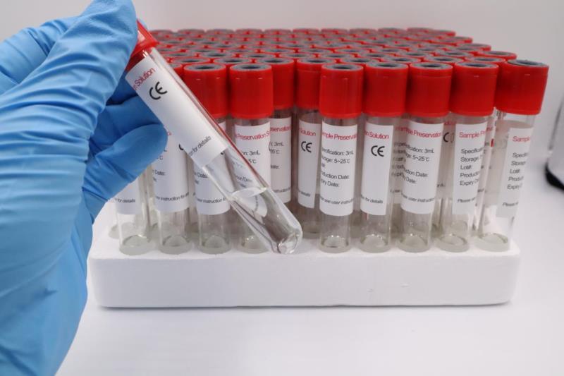 Mslvts03 Disposable Virus Specimen Collection Tube, Contagious Virus Blood Samples Tube