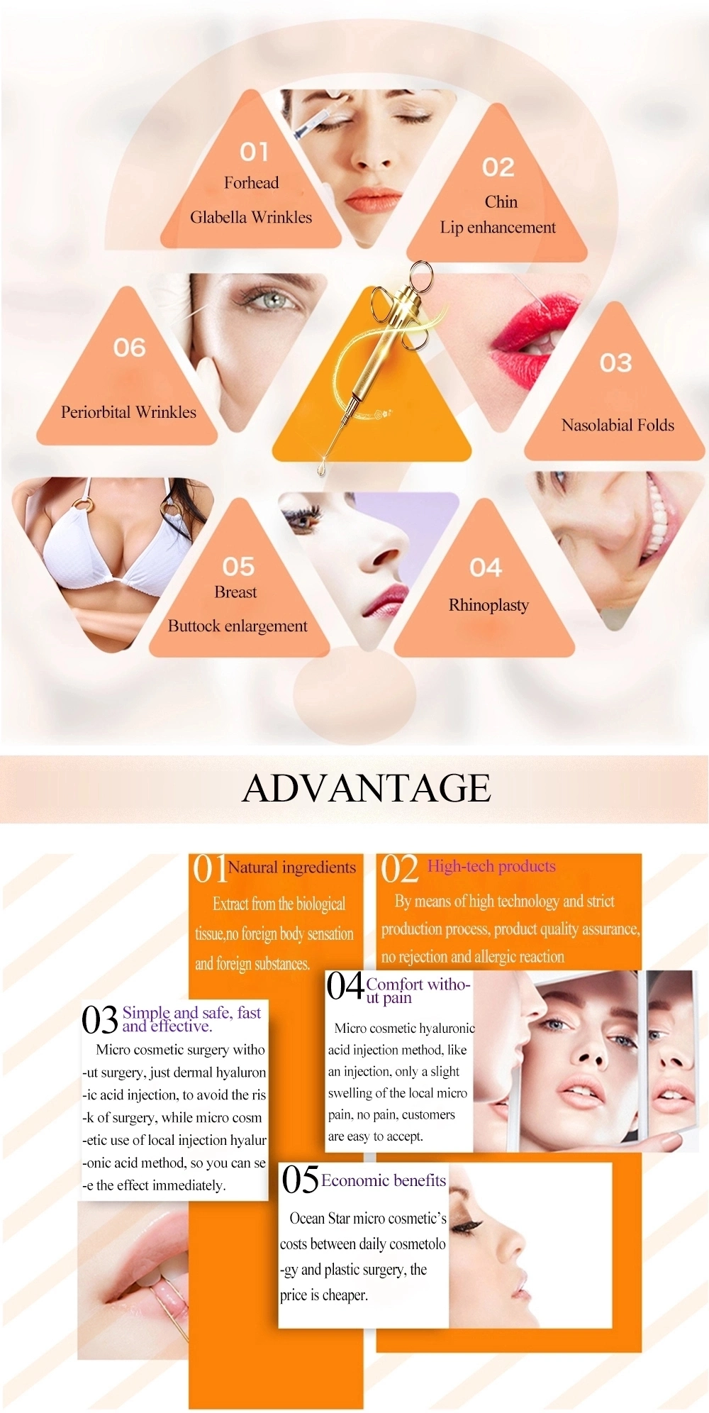 Inyectable Acido Hialuronico Lip Filler 1ml for Lip Augmentation Hyaluronic Acid Injection Filler