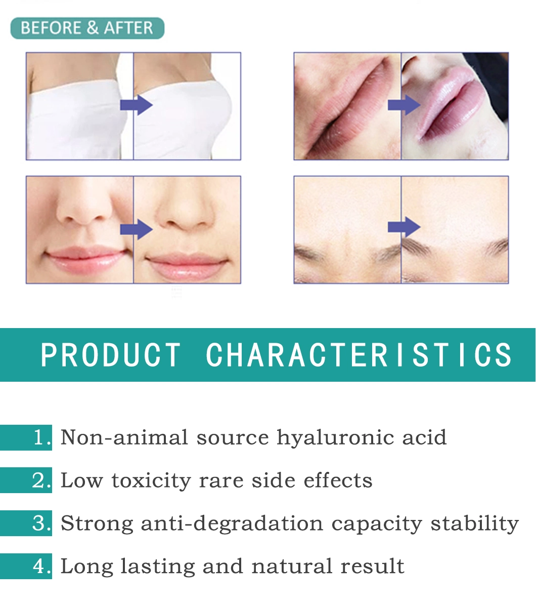 2020 Hyaluronic Acid Dermal Filler Cosmetics Penis/Lip/Breast/Butt/Chin/Enhancer/Facial Fill/ Injection Ha Filler