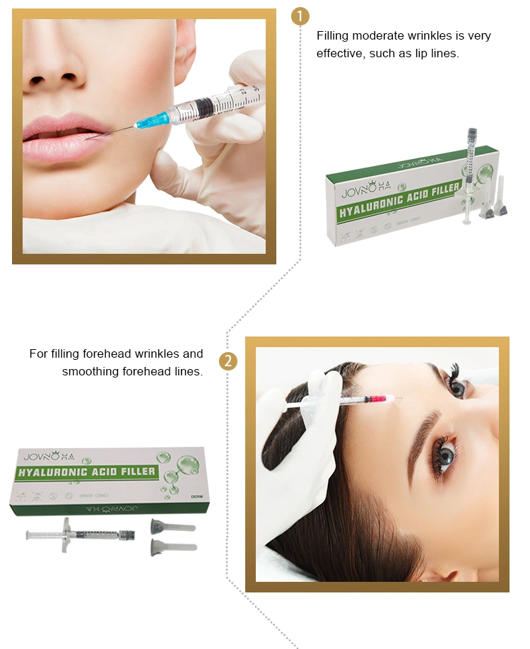 1ml Best Lip Enhancer Hyaluronic Acid Injectable Dermal Filler