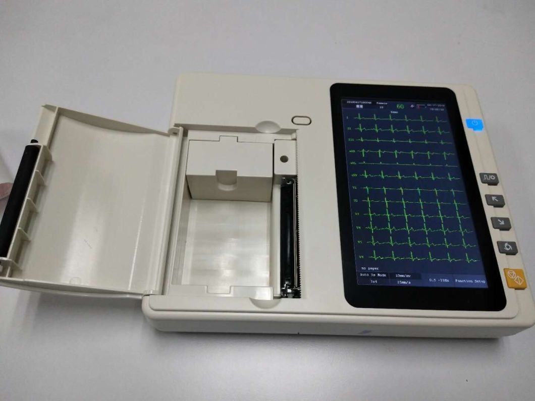 Touchscreen 6 Channel ECG Machine Medical Device with Interpretation