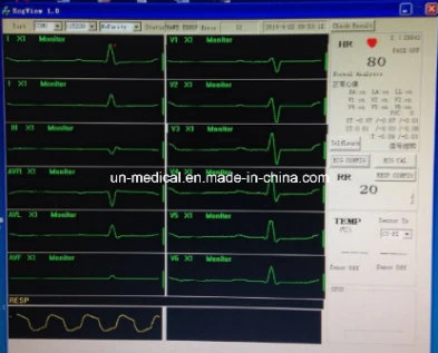 Medical ECG Measurement Board for Portable Cardiac Monitor