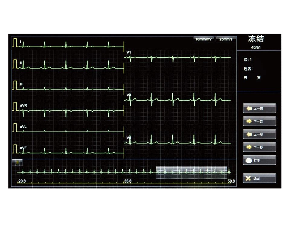 18 Channel Portable Digital Hospital ECG EKG Monitor Machine ECG EKG Electrocardiograph Machine