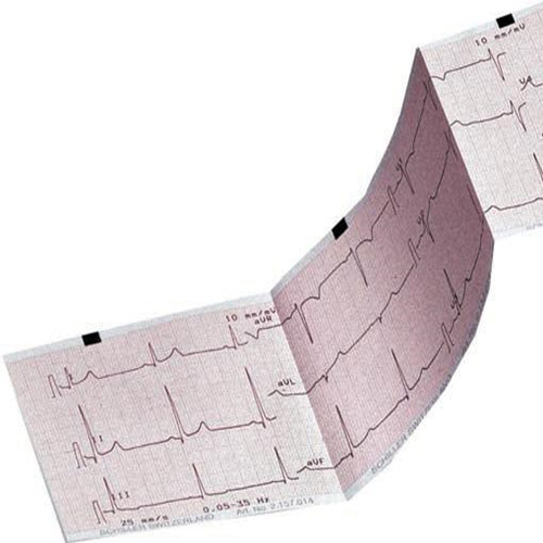 ECG Paper/EKG Paper/ECG Graph Paper