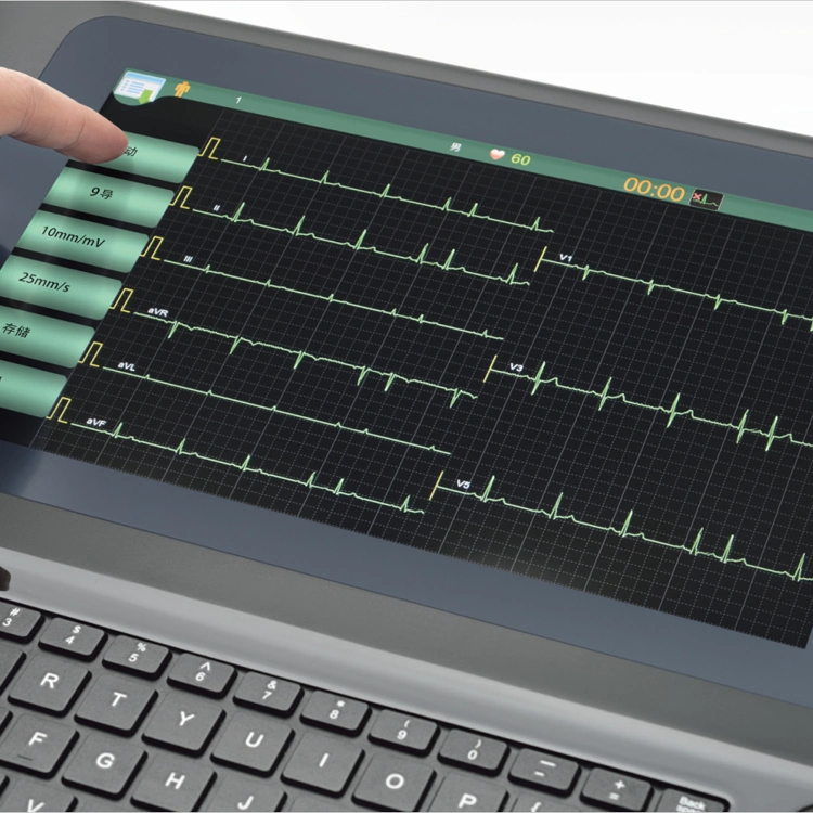 ECG 3 Channel Digital 12 Lead ECG/EKG Machine + Software Electrocardiograph/ Printer