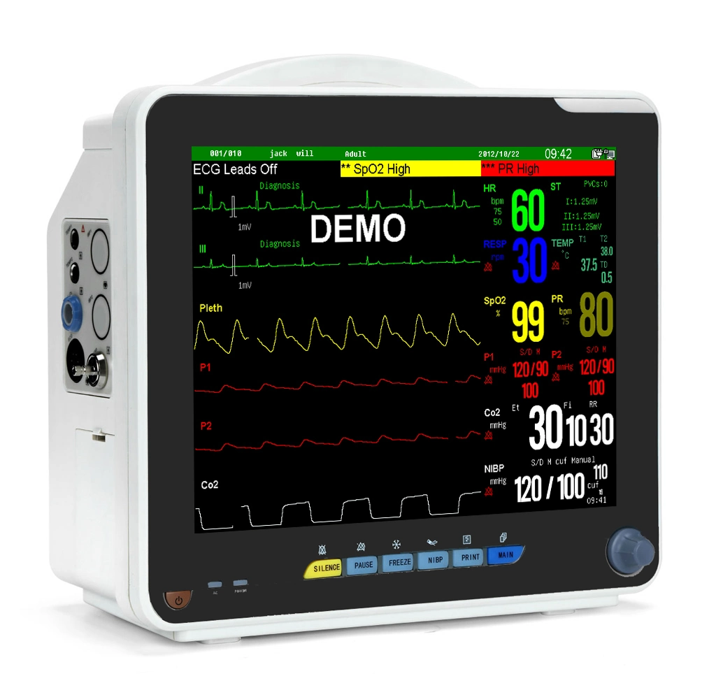 Sinnor Snp9000n Cardiac Monitor SpO2 Blood Pressure Monitor/Patient Monitor/ECG Monitor