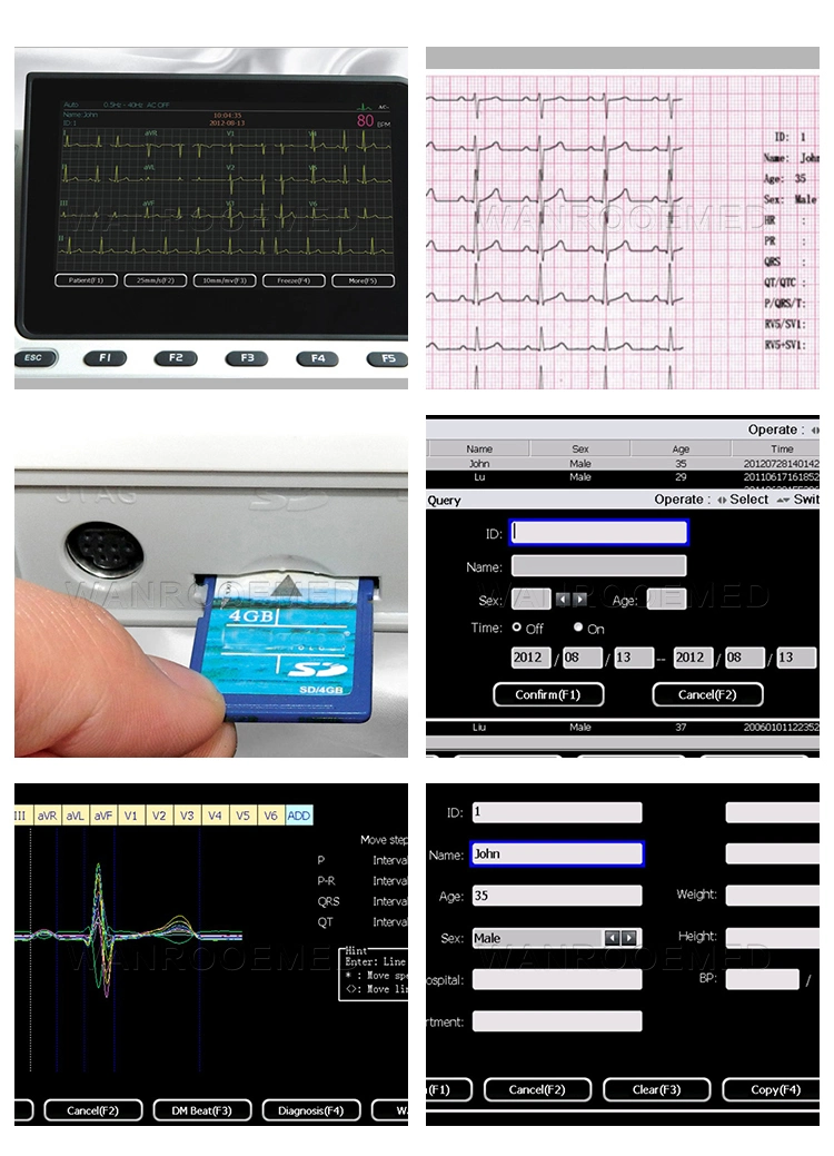 ECG601 Medical Equipment Handhold Digital 6 Channel ICU ECG Monitor Machine
