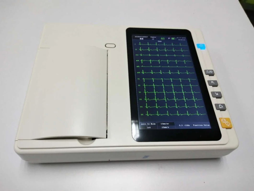 12 Lead Stress Electrocardiograph Portable ECG Machine with Touch Screen