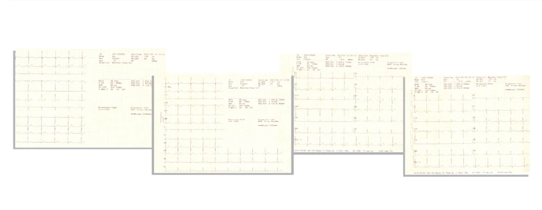 Portable Digital Touch Screen 12 Channel 12 Lead EKG ECG Electrocardiogram Machine ECG-1200b