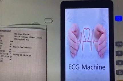 CE&ISO13485 Approved Excellent Quality 3 Channel Digital Mobile Medical ECG Machine with Touch Screen