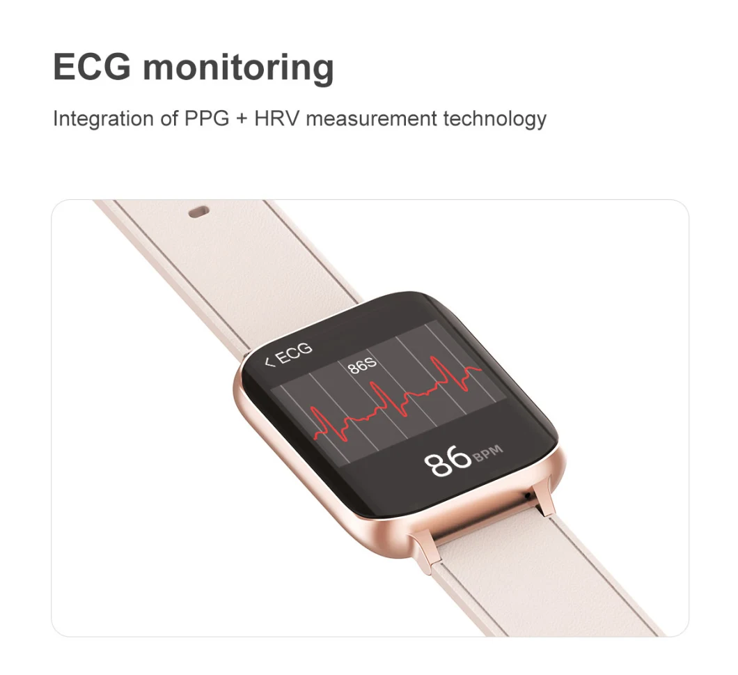 Smart Watch Music Playing Bt Call ECG Monitoring DIY Watch Face 420*485 Smartwatch