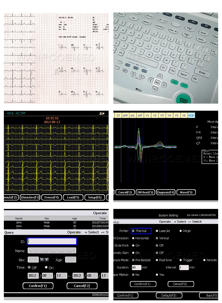 ECG1202 Hospital Portable Handheld Holter ECG Monitor Price