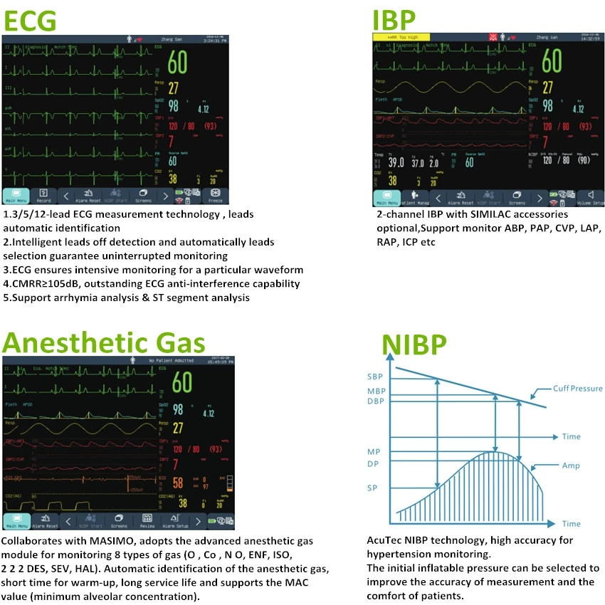 Medical Multi Parameter Monitor Portable Vital Signs Monitor NIBP SpO2 ECG Monitor