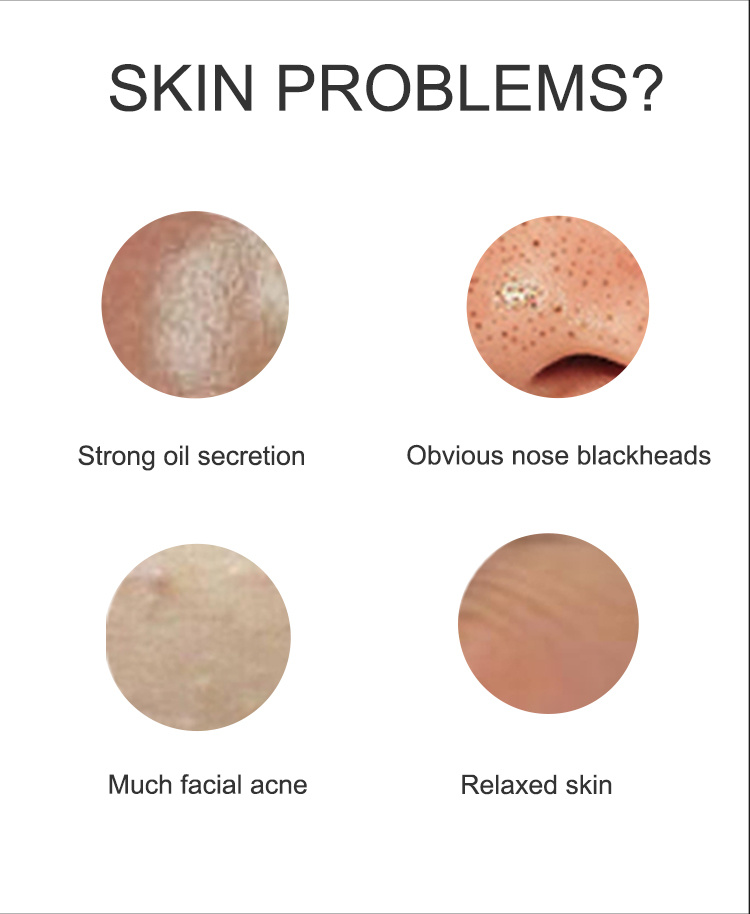 New Acne Removal Beauty Personal Care Equipment Skin Scrubber Facial Scrubber Portable Skin Scrubber