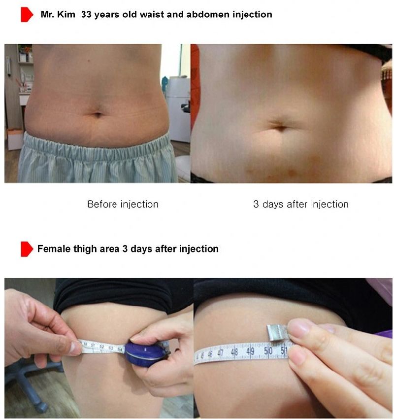 The Red Solution Slimming Fat Dissolving Lipolytic The Red Injection