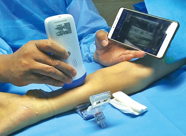 192 Elements Portable Wireless Medical Micro Convex Ultrasound Probe
