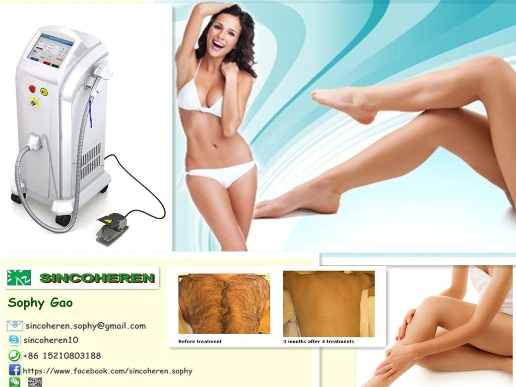 808nm Diode Laser for Permanent Hair Removal Beauty Device Medical Device