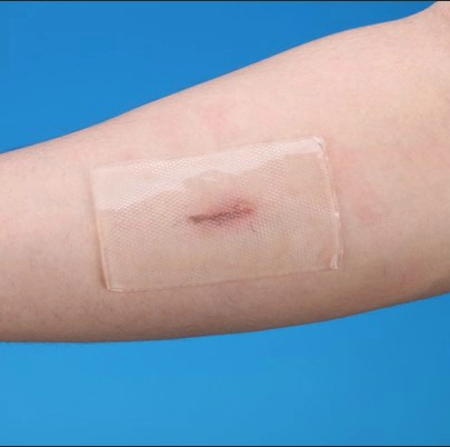 Silicone Gel Silicone Scar Treatment Keloid Silicone Gel Sheet Scar Similar to Cica Care