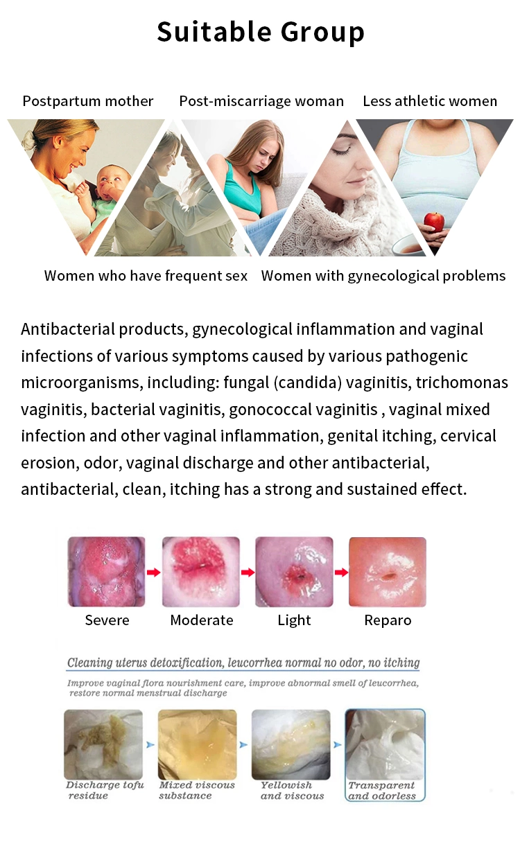 Gynecological Vaginal Clean/Women Vaginal Daily Care/Private Disinfect/Feminine Detox/Personal Care/Health Care