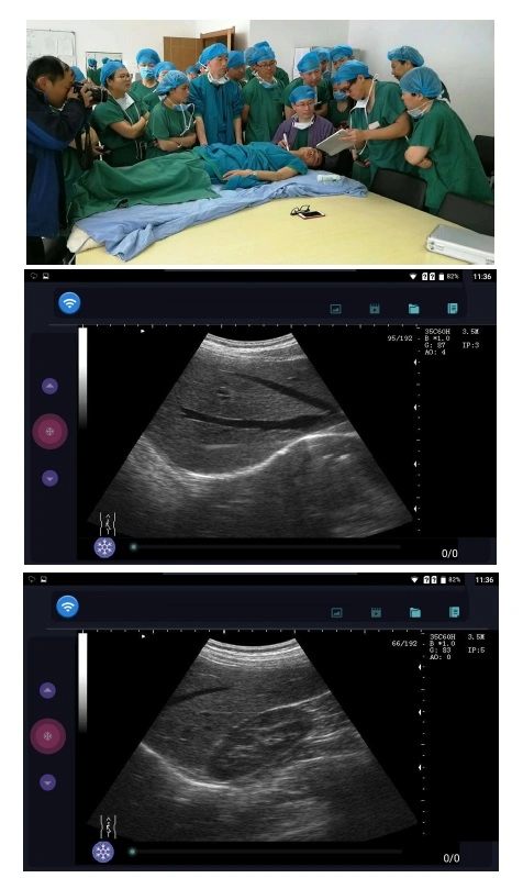 Wireless Ultrasound, Smart Phone Connect, Color Doppler/ Black and White