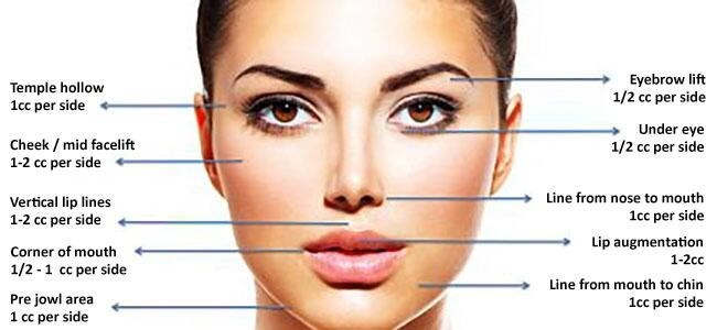 1ml Deep Hyaluronic Acid Ingredients Facial Dermal Fillers for Facial