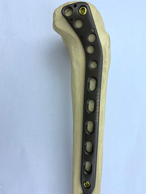 Hot Selling Orthopedic Plate Proximal Tibial Lateral Locking Plate