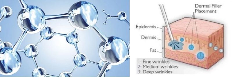 Skinject Hyaluronic Acid Ingredients Facial Dermal Fillers