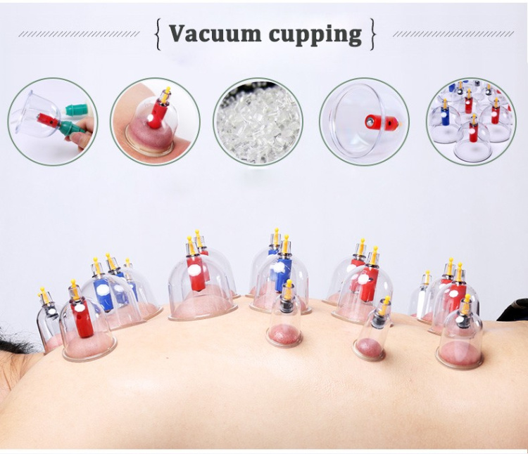 Cupping Set- Male Cupping/Femeale Cupping