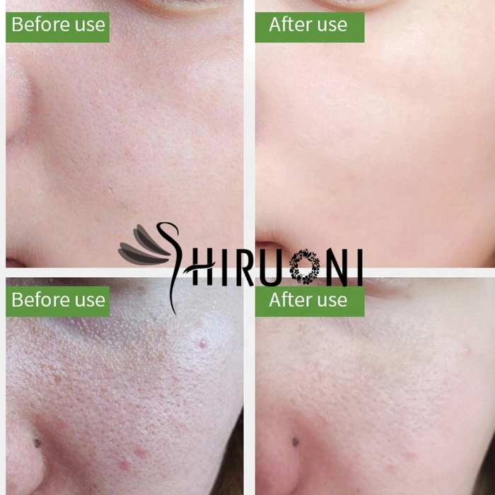 OEM Natural Green Tea Anti-Acne Moisturizer Whitening Face Cream