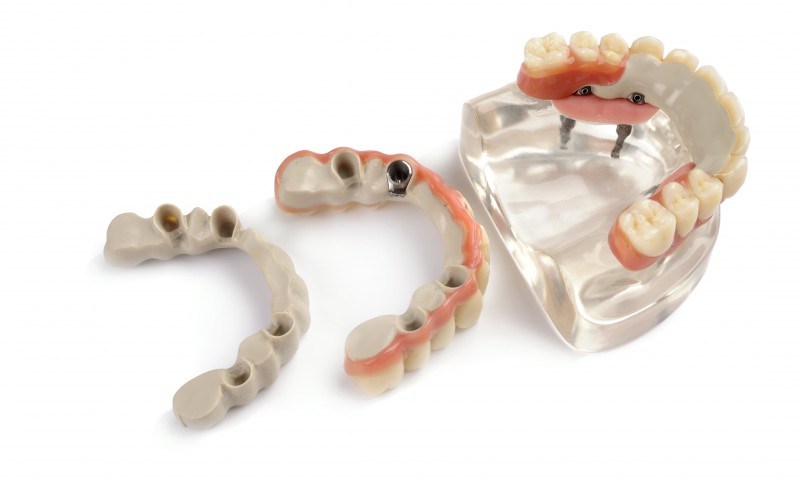 Casting Full Zirconia Dental Implant Crown / Peek Dental Implant High Compressiv