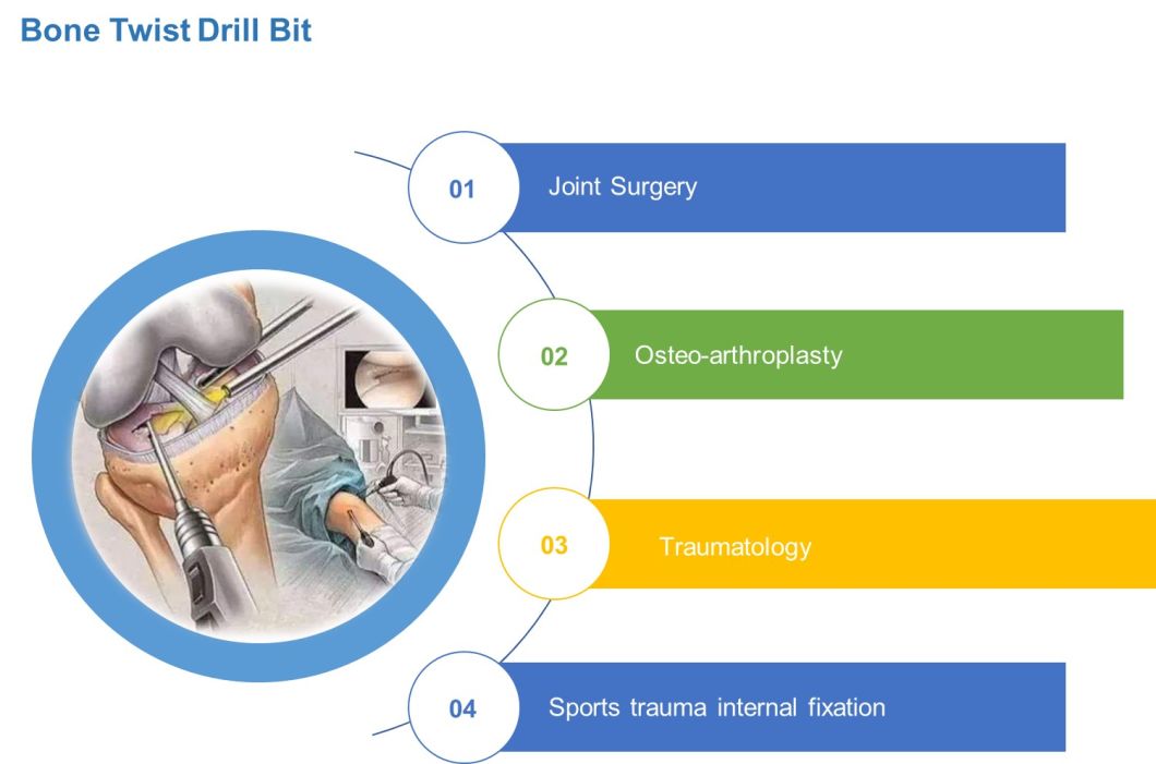 Bone Twist Drill Bit/Bone Pin/Orthopedic Drill Bit/Bone Bur/Surgical Bur/Single-Use Sterile Bone Pin