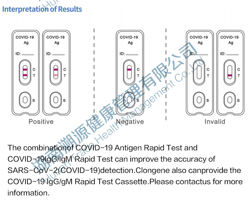 Fast Reaction Rapid Diagnostic Kit Antigen Rapid Test