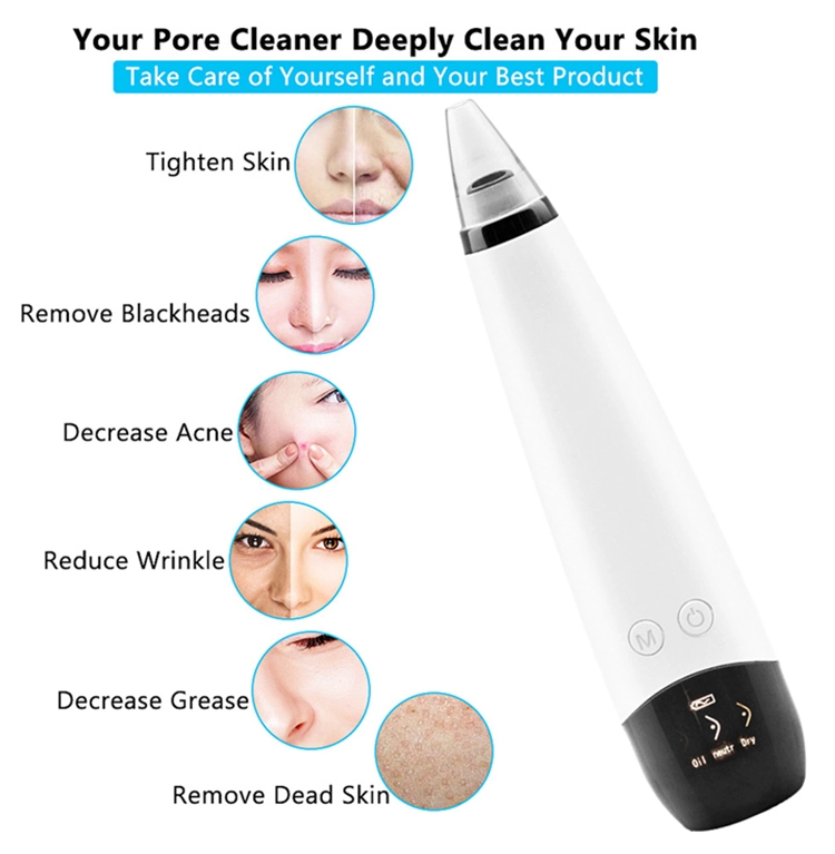 Blackhead Remover Pore Vacuum, Facial Vacuum Pore Cleaner with USB Rechargeable