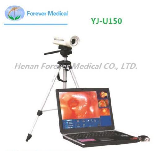 Portable Medical Gynecologic Colposcope Equipment for Checking The Vagina