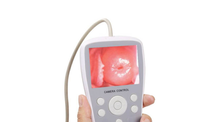 Portable Medical Gynecologic Colposcope Equipment for Checking The Vagina