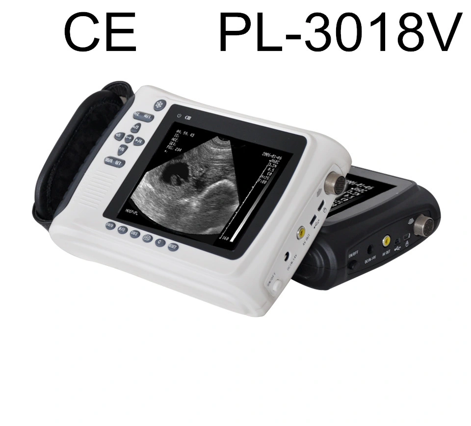 Veterinary Ultrasound Systems for Equine, Large Animal, Small Animal, Zoo Mammal, and Marine Mammal Medicine