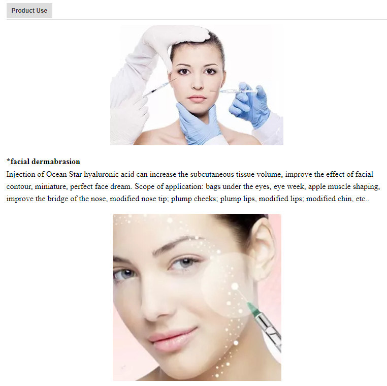 Ocean Star 100cc Hyaluronic Acid Dermal Filler to Breast Enhancement Injection /Chin Injection/Buttock Injection