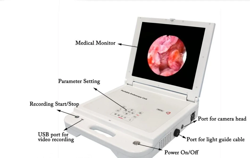 Ent Diagnostic Machine Endoscopic Camera for Pet Dog Veterinary Surgery