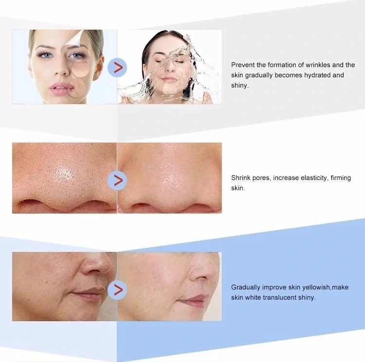Meso Whitening Mesotherapy Solution Injectable Hyaluronic Acid 5ml
