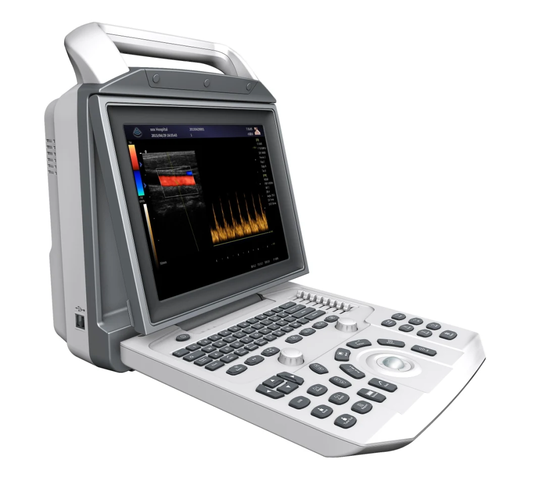 My-A026 Vet Hot Selling Medical Full Digital Portable Vet Ultrasound Machine