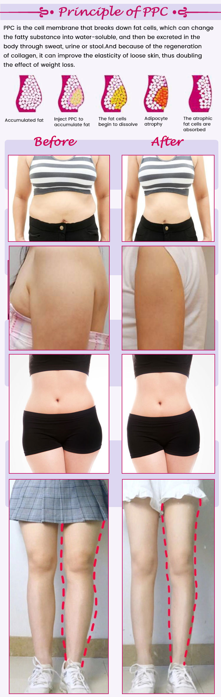 Korea Quality Lipolysis Weight Loss Injectable Red Solution Weight Loss Liquid Injections