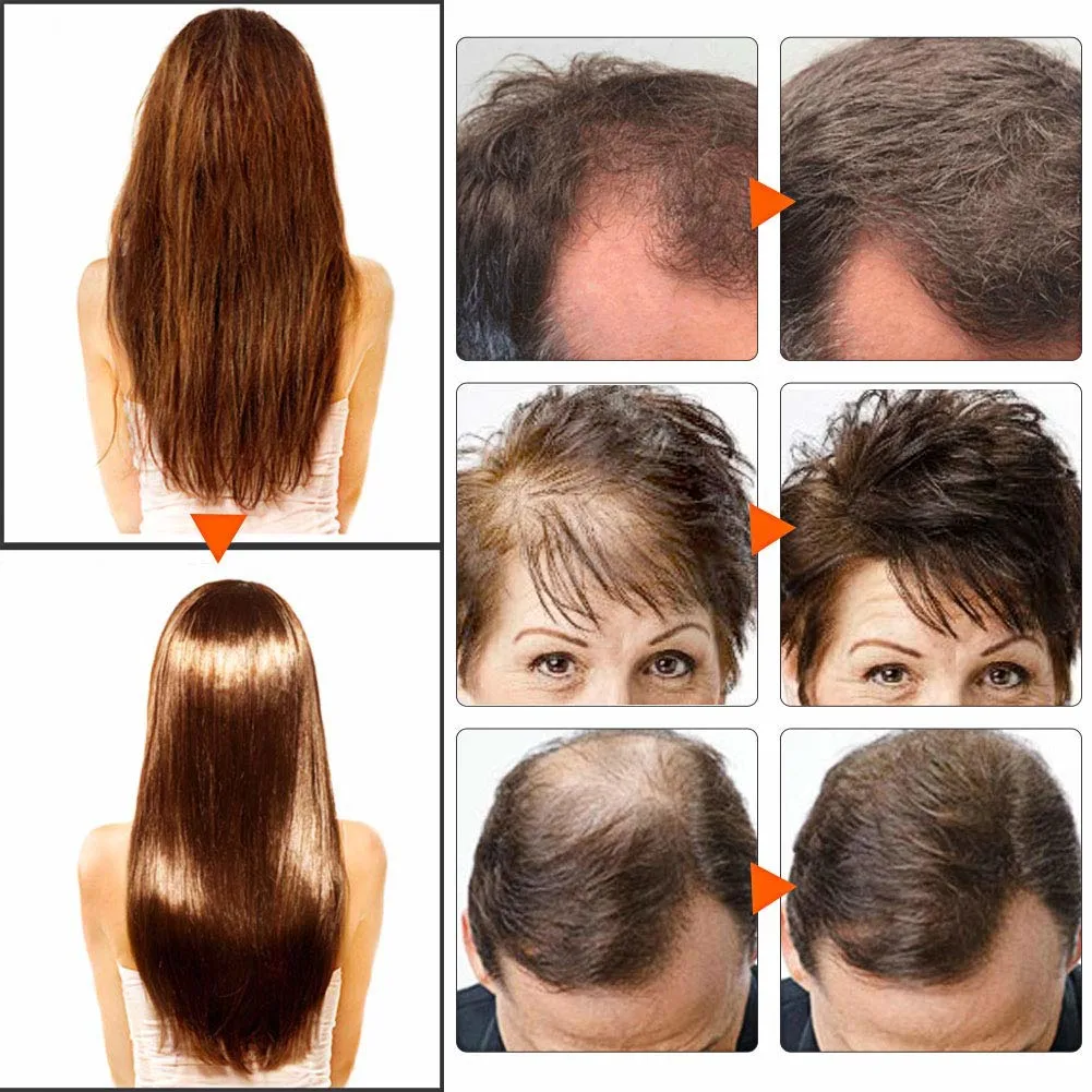 Control Hair Fall Anti Hair-Loss Hair Shampoo (200ml, 400ml, 500ml 1L, 5L)