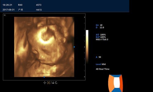 12" Screen Full Digital Clear Image Laptop Ultrasound Scanner (YJ-C90)