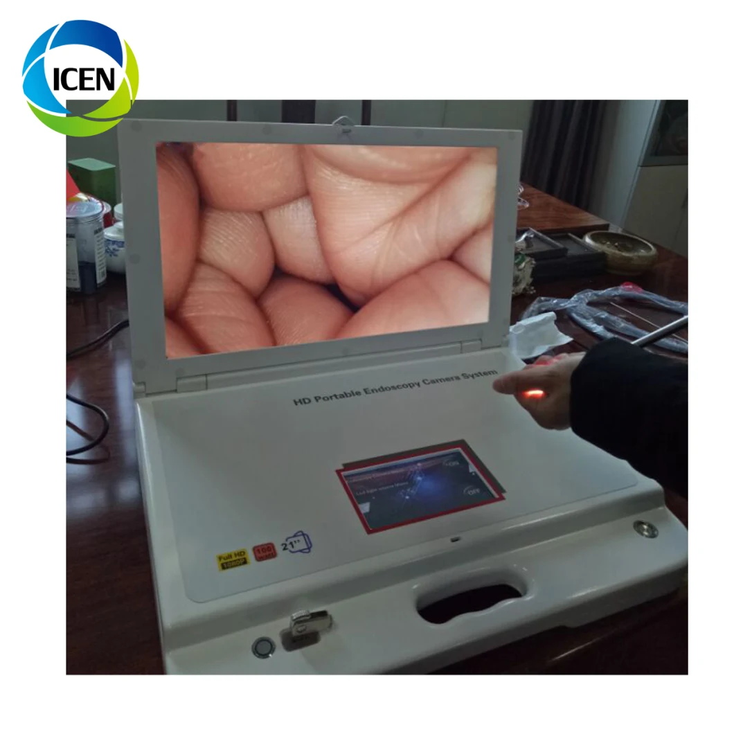 IN-GW603 Portable LED monitor HD endoscope ent Endoscopy camera machine