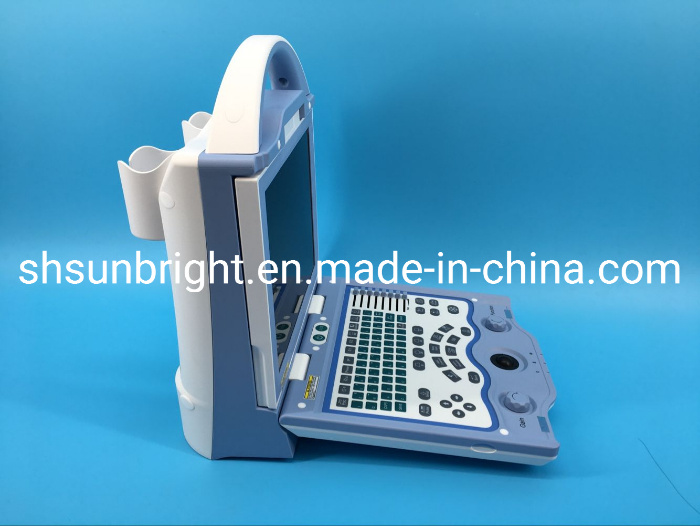 High Cost Performance Digital Ultrasound Medical Scanner for Farmers