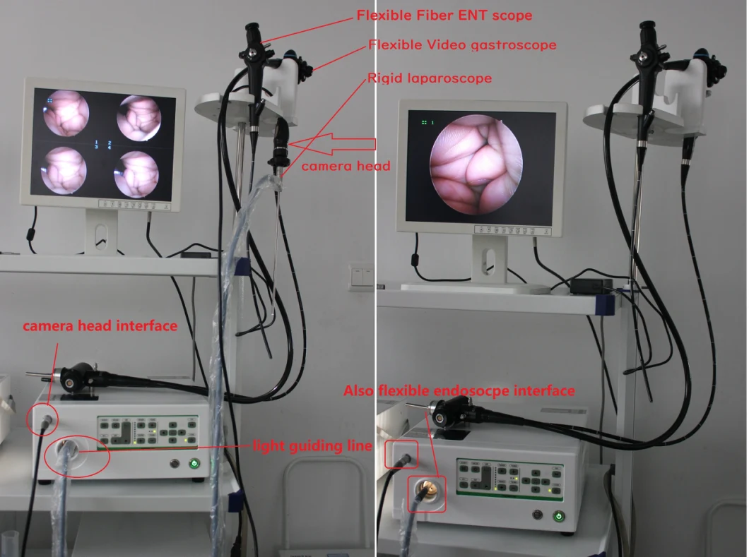 Hvet-9000A Electric Veterinary Video Endoscope /Flexible Endoscopy Tower Laparoscopic Tower Camera System