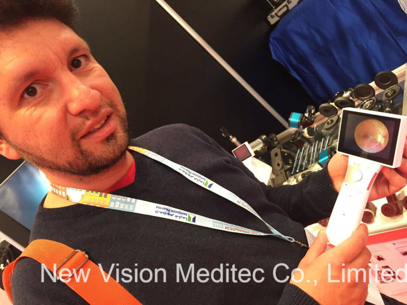 Digital Non-Mydriatic Portable Retinal Camera