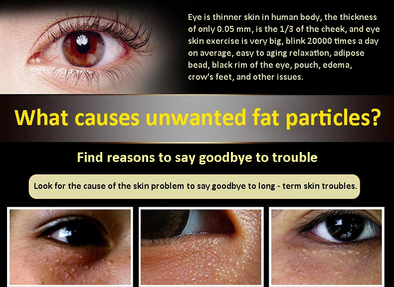 Anti-Wrinkle Eye Cream Essence Anti-Aging Anti-Swelling Fine Line Eye Cream