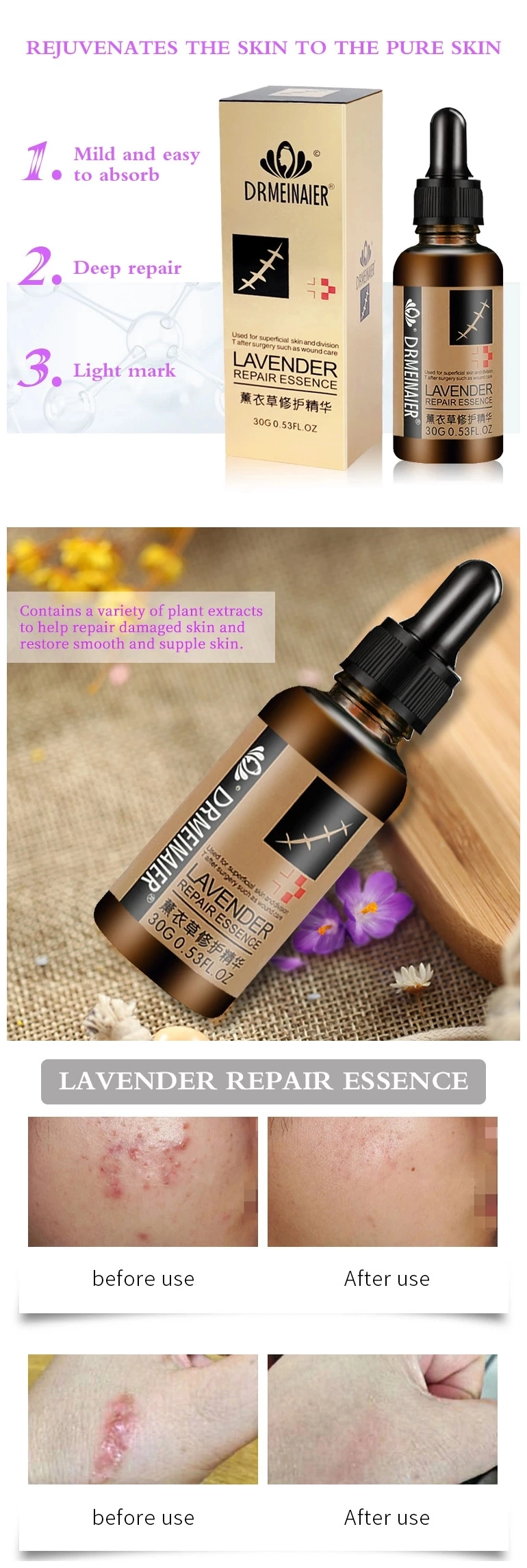 Highly Effective Natural Lavender Skin Care Repair Essence Face Serum Private Label