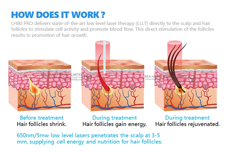 Laser Hair Regrowth Helmet Hair Care Therapy Anti-Hair Loss